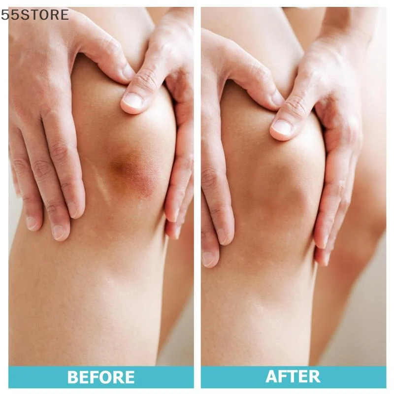 1 لفة اضافية رقيقة لينة الغروانية المائية الفرقة المعونة خلع الملابس مقاوم للماء ذاتية اللصق ندبة غطاء الشريط للعناية بالفعال الجروح