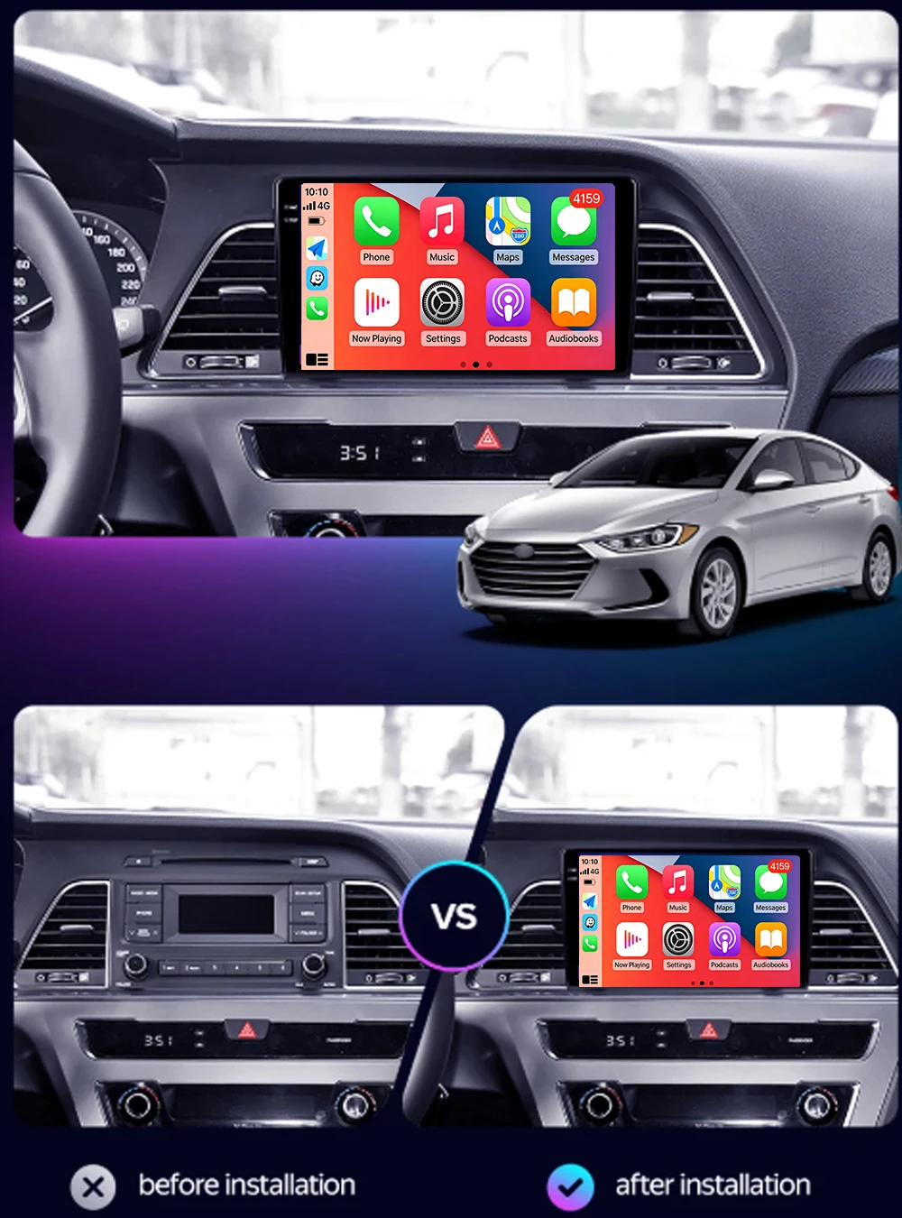 Android 16 Carplay&Auto Car Radio Navigation Multimedia Stereo Player QLED GPS For Hyundai Sonata 7 LF 2014 - 2017