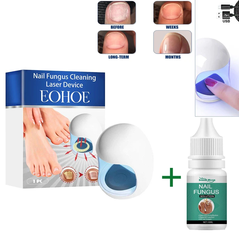 Dispositivo do tratamento do laser do fungo do prego, Paronychia Anti-Infecção, onicomicose, Unha do pé, cuidados enfiados dos pés, essência