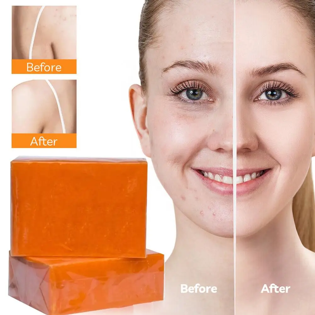 Kojic Acid Soap 100g Pack Dark Black Skin Lightening Soap Glutathione Hand Brightening & Made Bleaching Skin Soap Z3U5