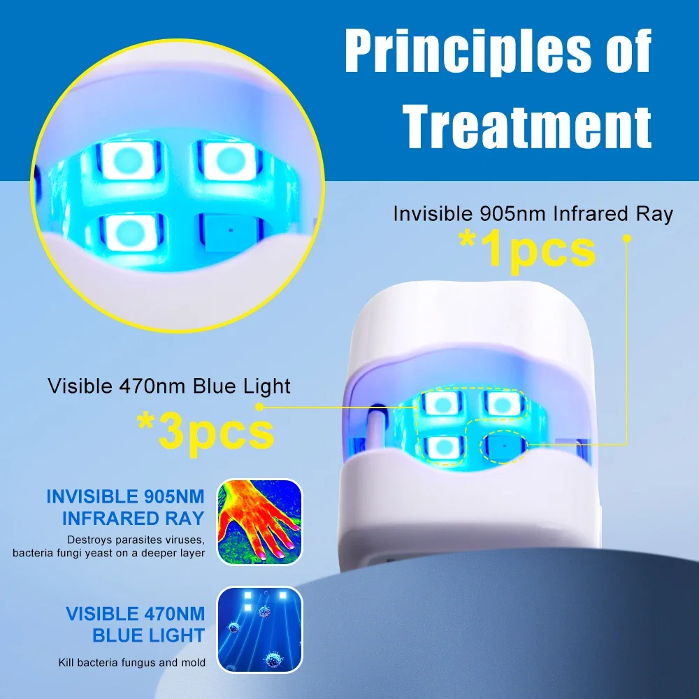 Nail Fungus Laser Treatment Effectively Remove Toenail Repair Laser for Nail Fungal Decvice Onychomycosis Therapy Treat