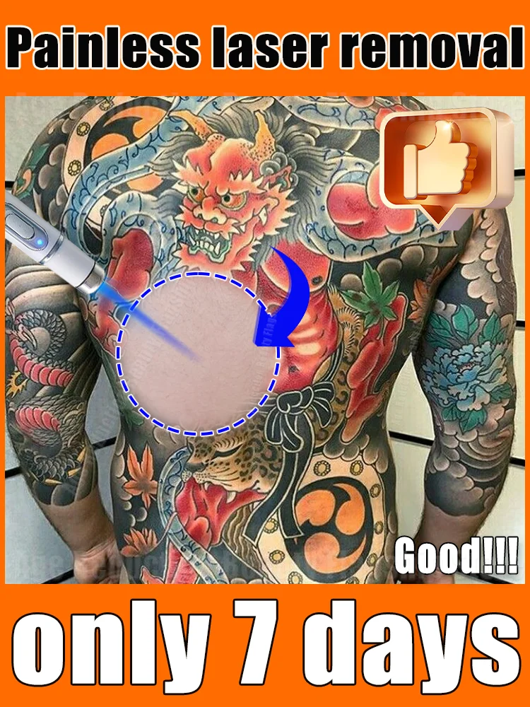 

Hot-selling products in 2025:Pᴀɪɴʟᴇss ᴛᴀᴛᴛᴏᴏ ʀᴇᴍᴏᴠᴀʟ ʟᴀsᴇʀ ᴘᴇɴ,ʙʟᴜᴇ ʟᴀsᴇʀ ᴜᴘɢʀᴀᴅᴇᴅ ᴛᴏ ᴛʜᴇ sᴇᴄᴏɴᴅ ɢᴇɴᴇʀᴀᴛɪᴏɴ