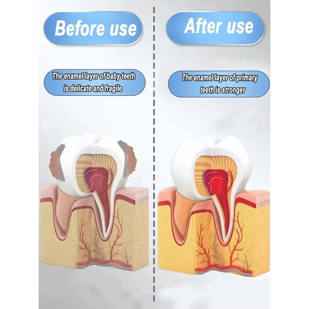 يزيل التجاويف بشكل خاص يزيل البكتيريا عن طريق الفم ويدعم إصلاح اللثة #5