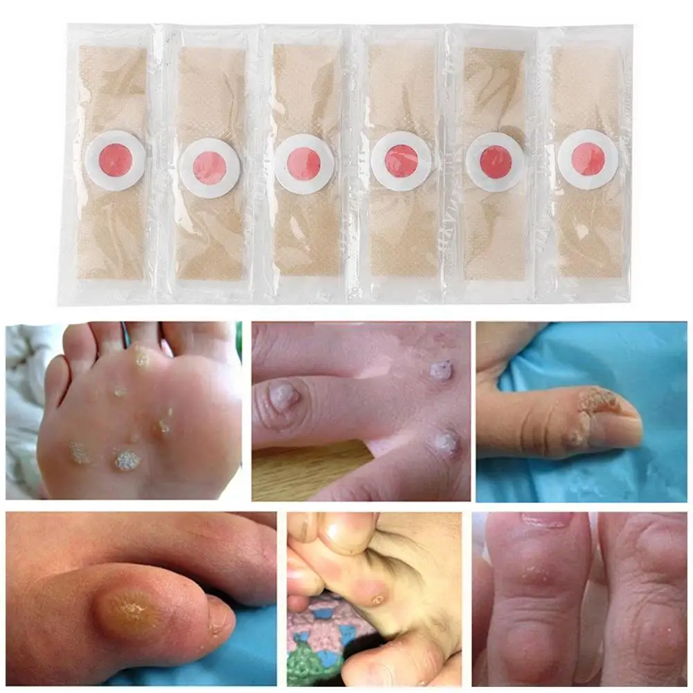 6PCS Corn Patch Corn Plaster Remover Corn Toe Pads Patch Adhesive Callus Cushion Non-woven Fabric Toe Corn Callus Removal