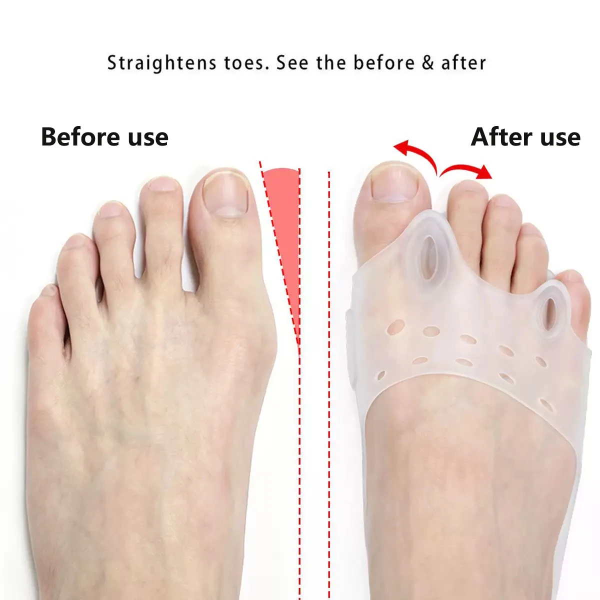 2-Piece Set: Elastic SEBS Toe Separator and Forefoot Pad – Shock-Absorbing, Anti-Chafing, with Elastic Securing Strap