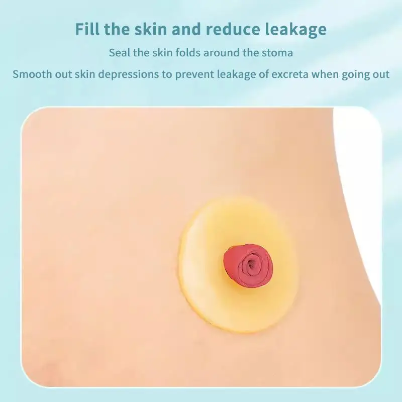 10Pcs Baseplates Stoma Care Products To Protect Skin Anti-Leakage Ring For Colostomy Bag Ostomy Paste Ring