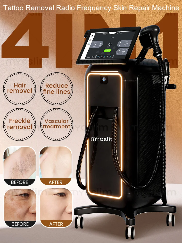 

4 IN 1 Soprano Titanium Ice Platinum RF Diode 755NM 808NM 940NM 1064nm 4 Wave Laser ND:YAG Machine Painless Hair Removal Machine