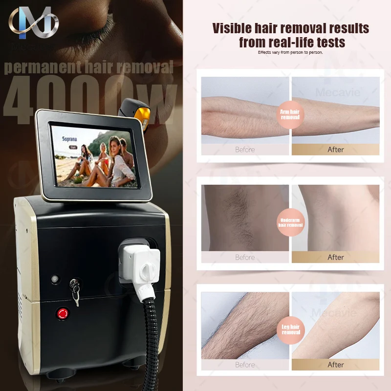 755nm 808nm 940nm 1064nm Diode Hair Removal Machine Ice Cooling Beauty Equipment Touch Screen Salon Device