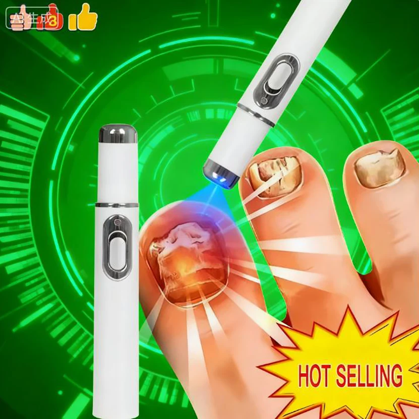 

Лазерная ручка, синий свет, лазерный инструмент для очистки ногтей, инструмент для ремонта корней