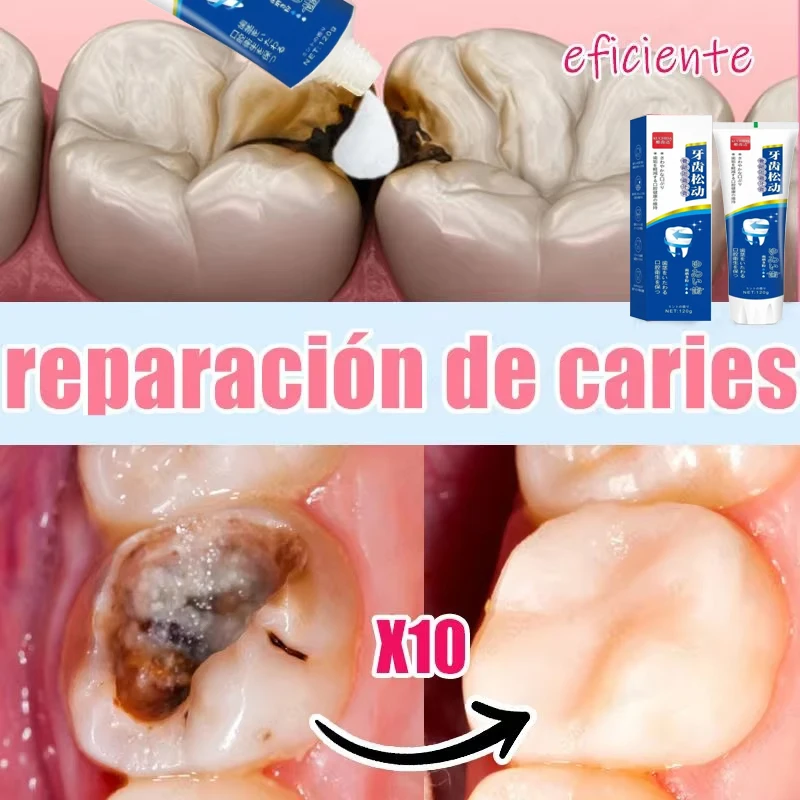 

Whitening Toothpaste Fresh And Bright Breath Removing Stains Cleaning Teeth Odour Removal Bad Breath Preventing Periodontitis