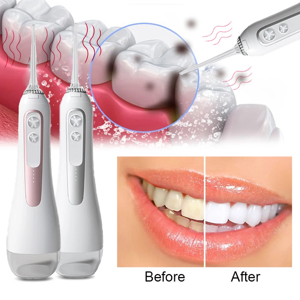 Dental oral Irrigator teeth cleaning cordless portable water flosser