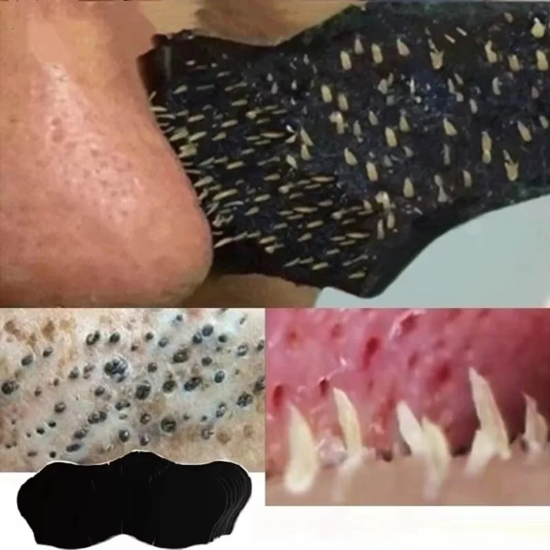 20/50/100 pçs nariz cravo removedor máscara tiras nasais cabeça preta peel off adesivo rosto acne cravo poros máscara mais limpa