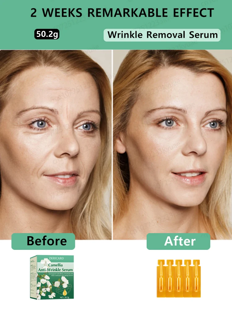 Anti Wrinkle Aging Instant Effect Remove Facial Wrinkles