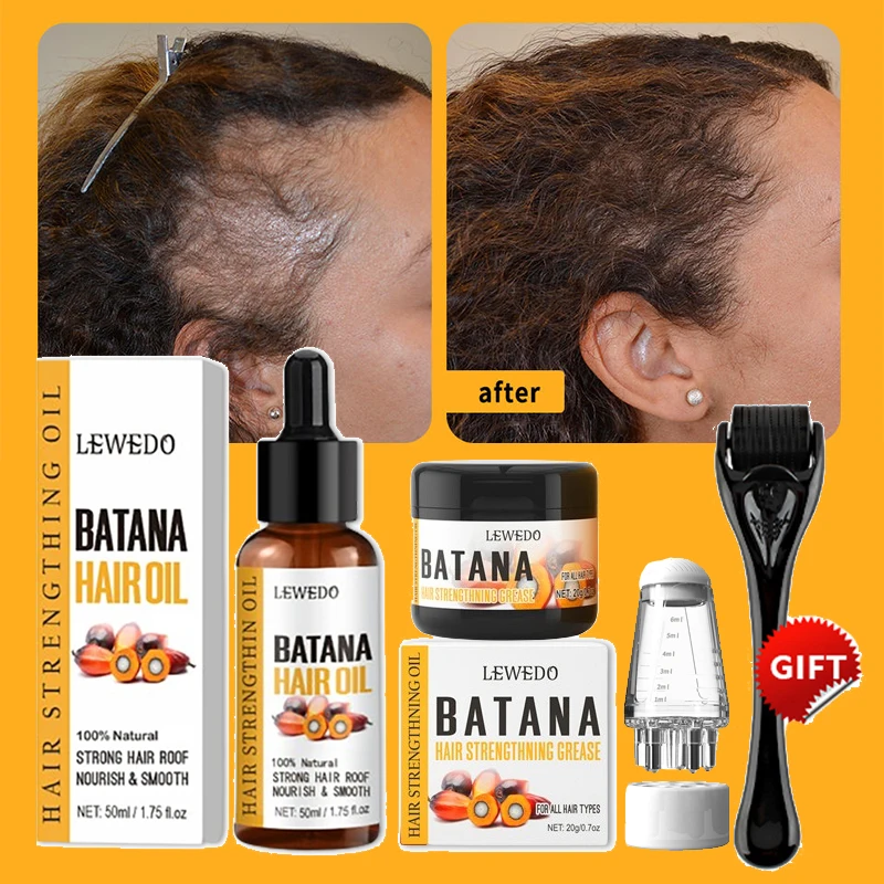 LEWEDO Batana Oil Hair Growth Kit African Fast Hair Growth Batana Butter Hair Mask Anti Hair Loss Hair Regrowth Treatment Serum