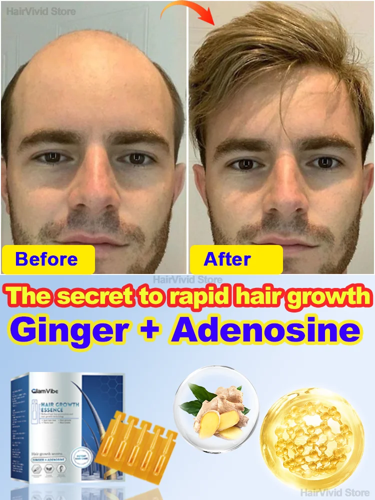 

Fixed hair,hair fix，Regeneration，Best sales in 2024