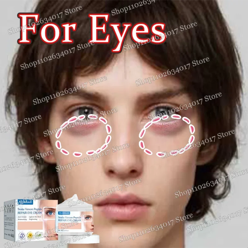 ᴴᴼᵀ Eye Cream l removes wrinkles, fights sagging and reduces pigmentation