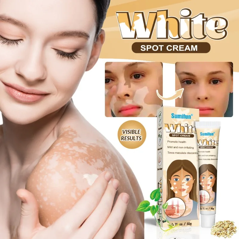 

Vitiligo Care Cream, Vitiligo Patch Cream, Body Skin Care External Ointment DZ1007302