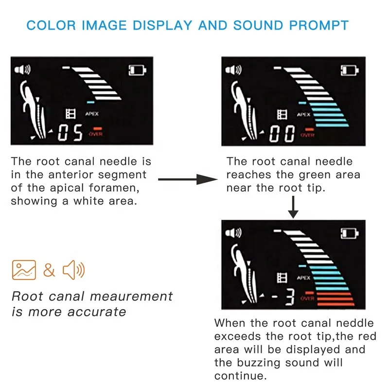 Endodontics root canal meter Den tal Root Canal Endodontic treatment machine den tal apex locator