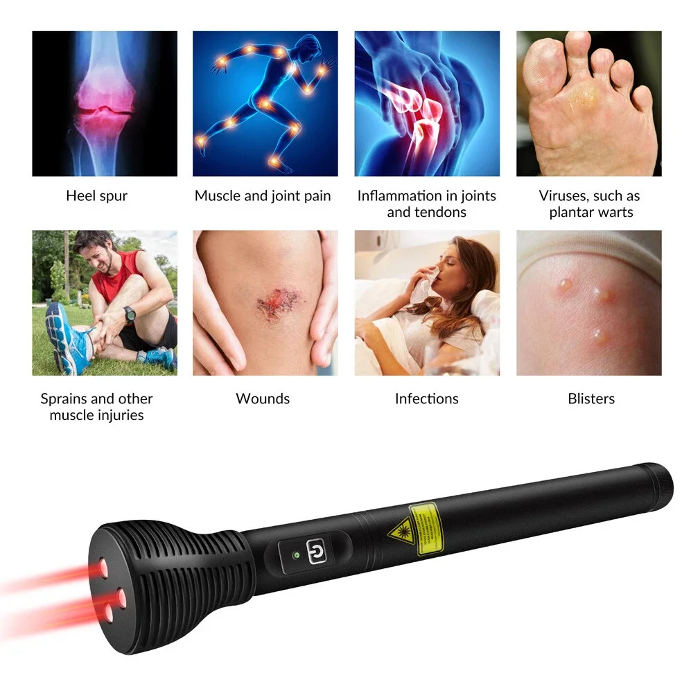 808nm 3W NIR Laser Therapy Device Needle‑Free Acupuncture Physiotherapy Machine for Muscle Strain Joint Pain Relief LLLT