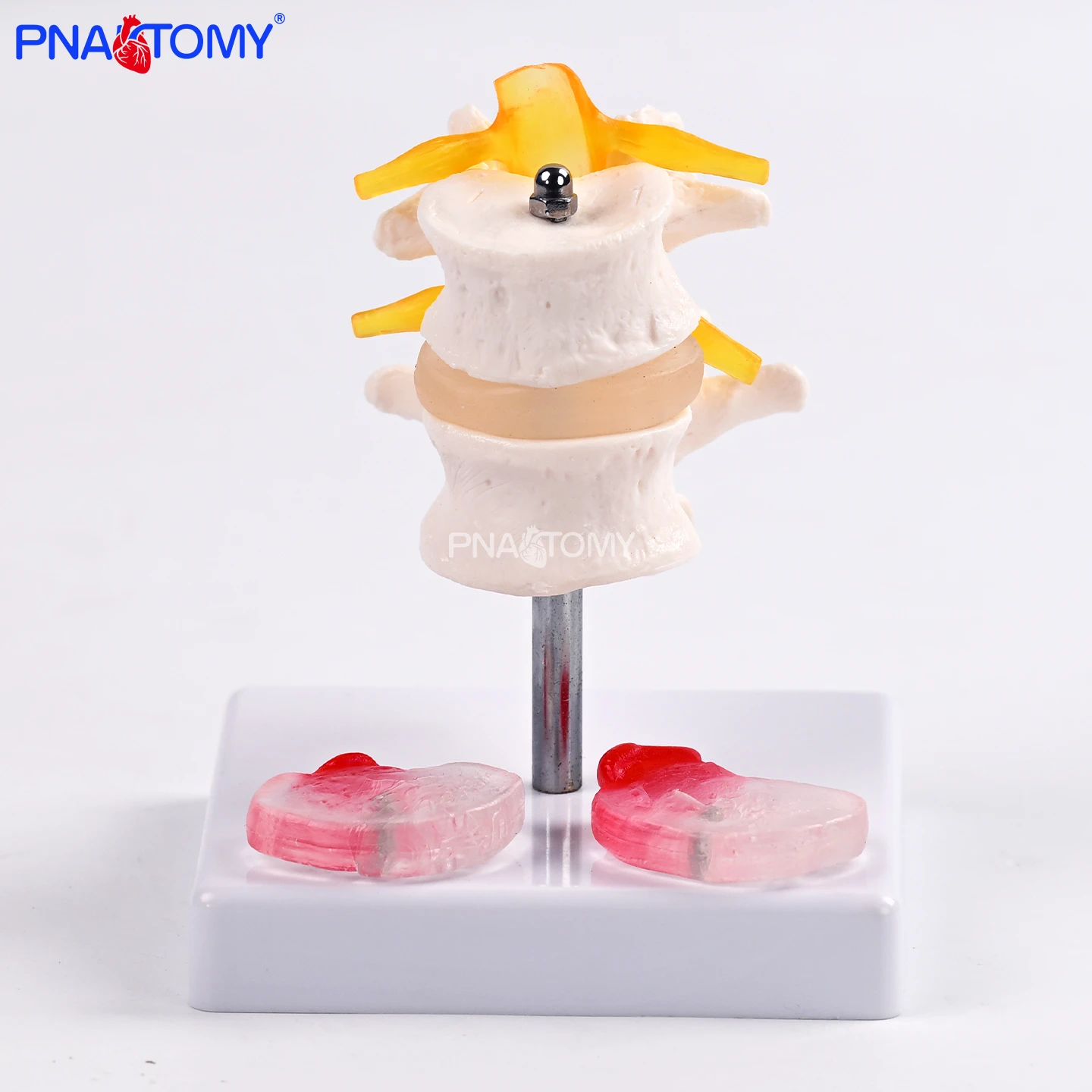 

Модель грыжи межпозвоночного диска, модель патологической структуры поясничного и шейного дисков, модель с вынимаемым ядром межпозвоночного диска и кольцом из волокон, учебные и тренировочные пособия для ортопедов, демонстрация для практикантов-студентов-