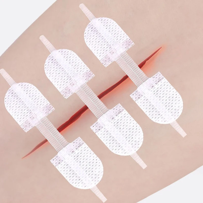 1Pc Strap Zipper Wound Closure Patches Breathable Seamless Elastic Zip Sutures Bandages For Wound Care Braces Supports‘