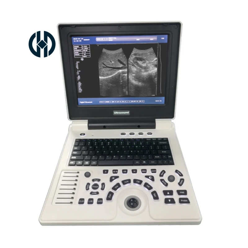 Color Tablet Ultrasound Portable Usg Machine Full Digital Portable B/W Ultrasound Scanner for human