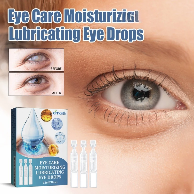 

Eye Drop Improve Eyesight Relieve Eyes Fatigue Redness Care Solution Moisturizing Dry Blurred Anti Myopia Blurred Enhance Vision