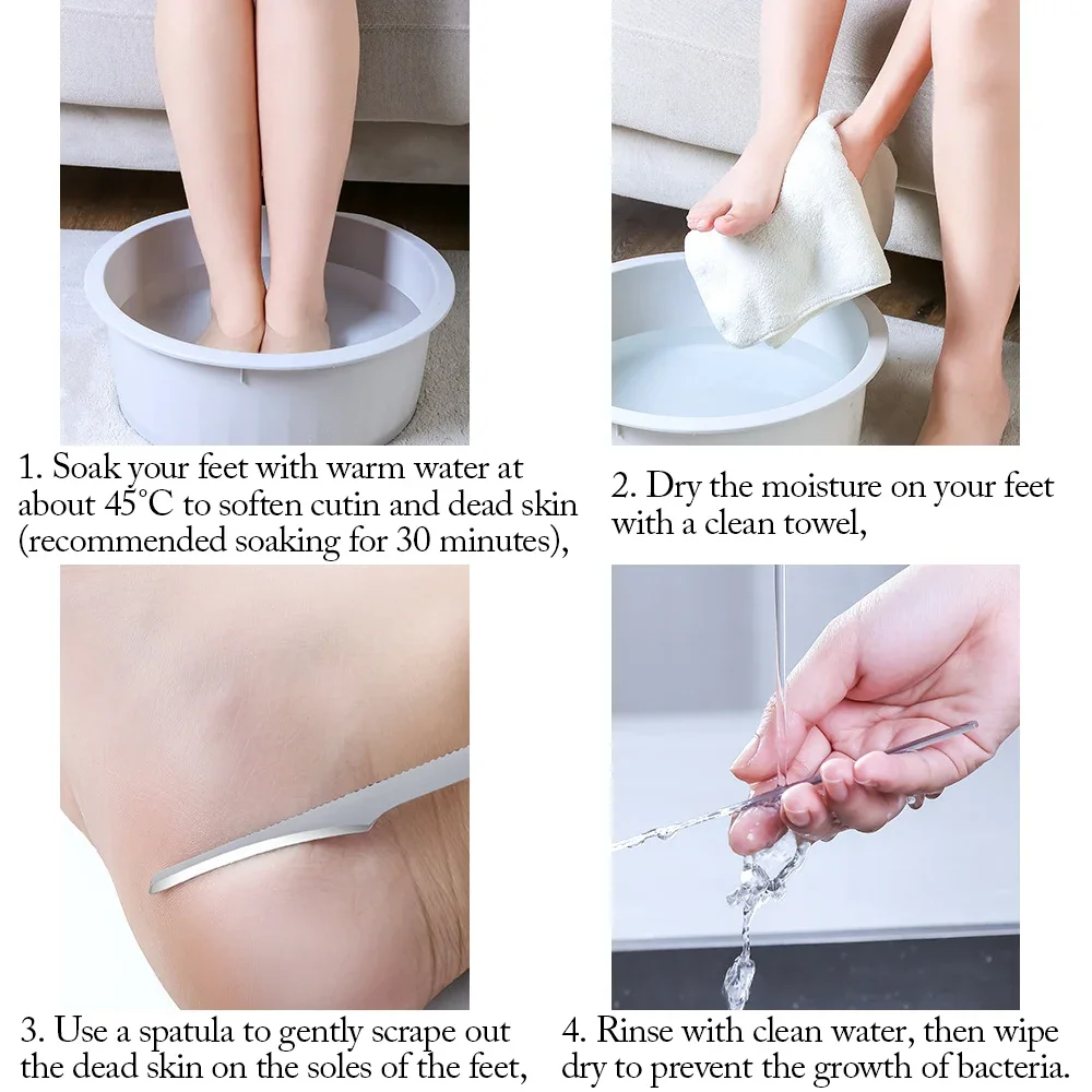 1-10pc Foot Callus Remover Stainless Steel Pedicure Exfoliating Scraper for Dead Skin&Calluses Foot Care Tool Beauty Accessories