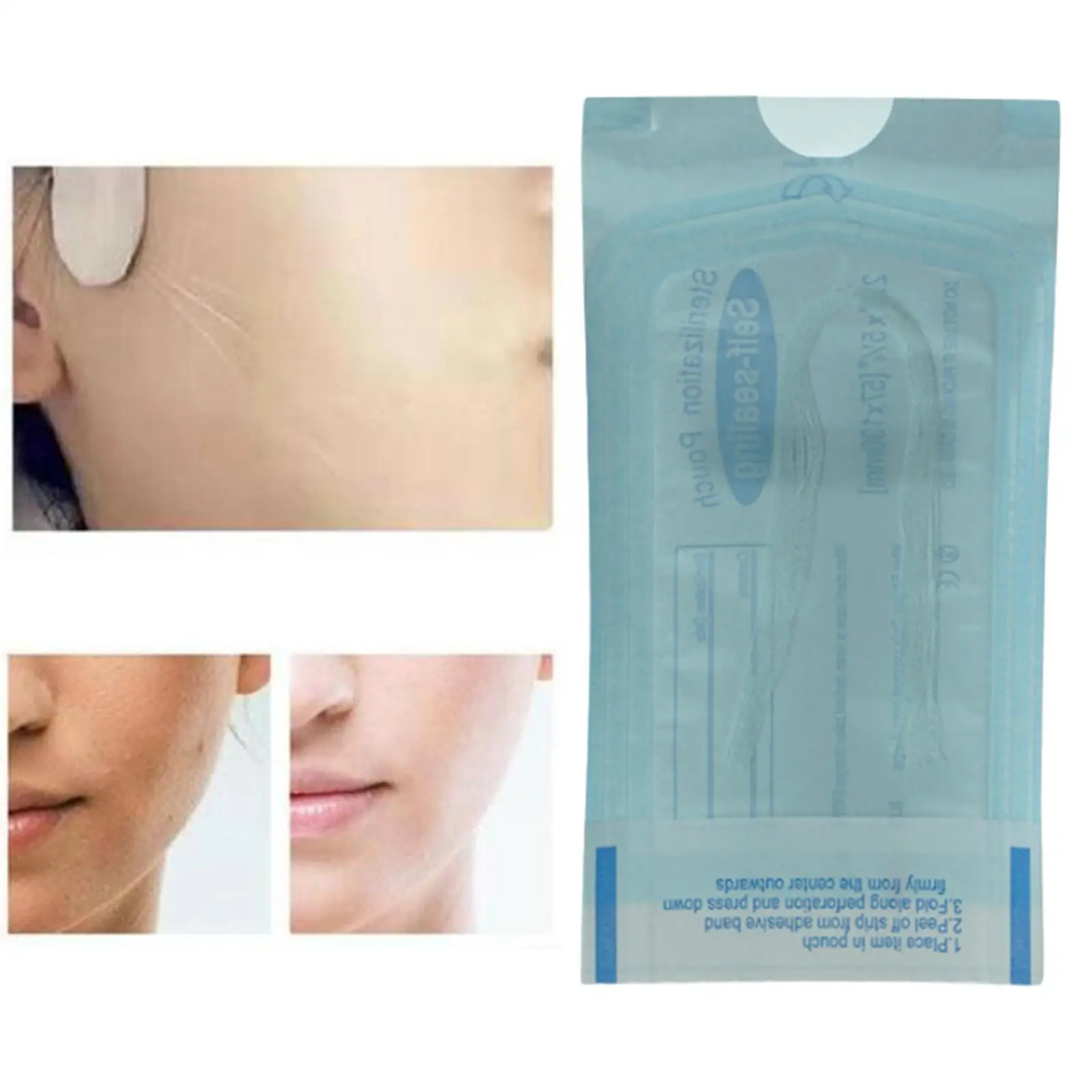12Pcs Soluble Protein Thread Lifting Skin Tightening Absorbable Thread