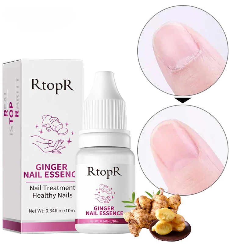 10ml Ginger Nail Essence nutriente unghie ruvide Anti Paronychia addensare Crack Nail Repair siero per il trattamento delle infezioni dell'unghia del piede