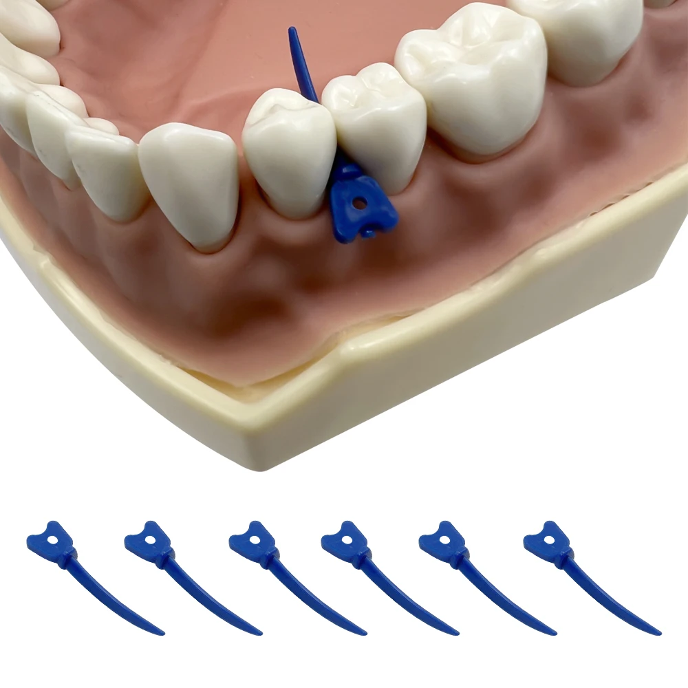 Jednorazowe kliny dentystyczne Tulwar do opasek matrycowych Sekcyjne wyprofilowane matryce metalowe z otworem Plastikowy klin stomatologiczny