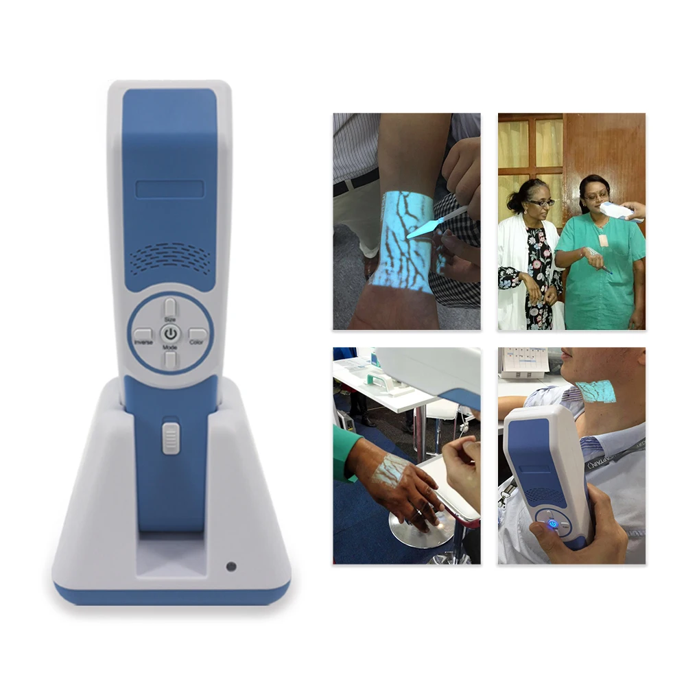 Near Infrared Light handheld vein detector vascular vein finder