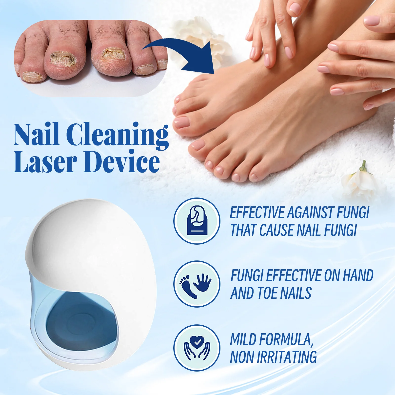 Toenail Nail Fungus Laser Treatment Repair Fingernail Laser Device Toenail for Foot Nail Fungus Essential Oil Onychomycosis Care