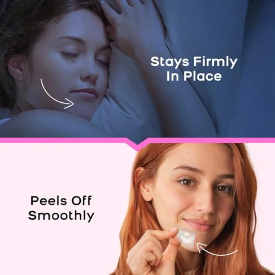 ハイドロコロイド顎ニキビパッチXL特大ニキビパッチ（顔、顎、体のニキビ用）ティーツリー、カレンデュラオイル配合（ニキビ跡用）