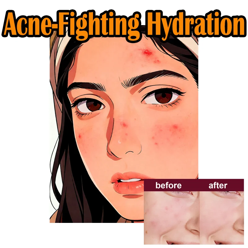 

Гликолевая кислота 7% тонизирующий раствор Обычное средство для удаления прыщей Увлажняющий светящийся уход за кожей лица Тоник с гликолевой кислотой для минимизирования пор