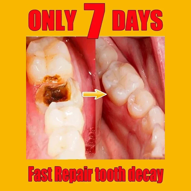 30g Teeth Whitening Anti-cavity Tooth Decay Fresh Bad Breath Repair Tooth Decay Remove Plaque Toothache Relieve Periodontitis