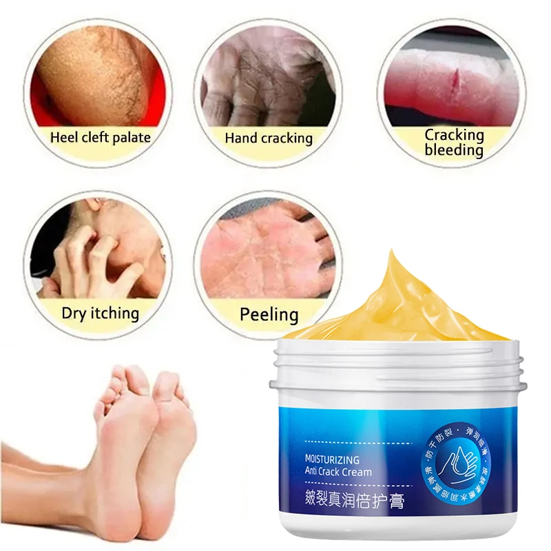 Anti-Drying Crack Hand Foot Care Cream Heel Cracked Repair Products Removal Dead Skin Moisturizing Whitening Nourish Skin Care