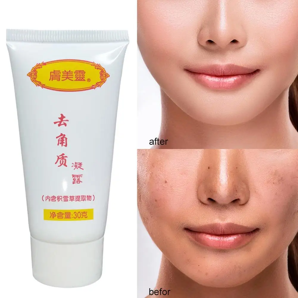 

Exfoliating Gel Dead Spot Remover Brighten Peeling Skin Hydrating Moisturizer Scrub Korean Gentle 30G Whiten Repair Care W3A7