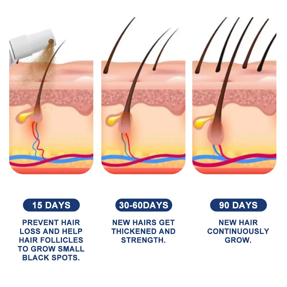 كريم نمو الشعر السريع المضاد لتساقط الشعر يمنع الصلع علاج فروة الرأس إصلاح الجذور الجمال الصحة العناية بالشعر للرجال والنساء