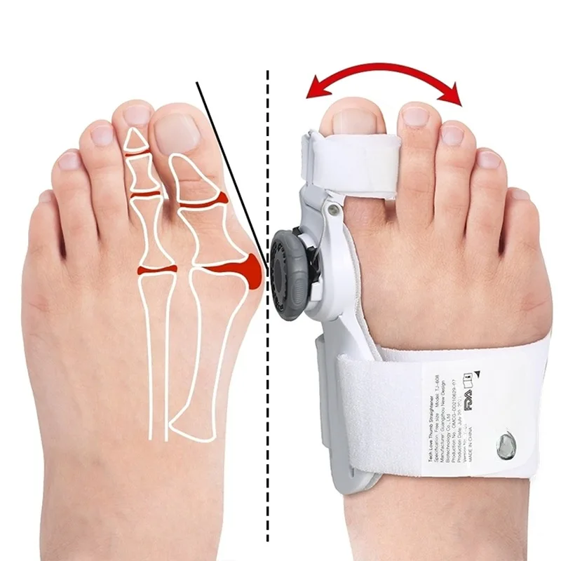 Multi-directional fixed foot Separator Orthopedic Toe Corrector Adjustable  Valgus For Foot Care Products