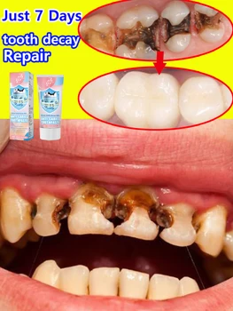 ฟันผุ ซ่อมแซมฟันผุ ยาสีฟันปกป้องฟัน