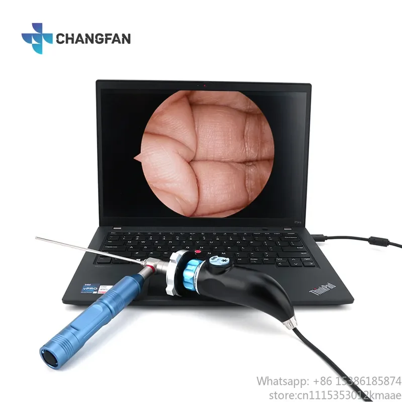 Vequyn Portable Full HD 1080P USB ENT Nose Endoscope System for Veterinary, ENT, and Urology Use