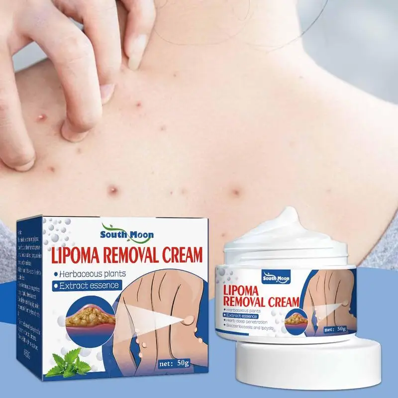 50g Lipoma Removal Cream The Whole Body Multiple Subcutaneous Conditioning Cream Eliminate Paste Fiber Paste Skin Care