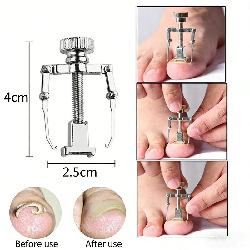 Ingrown Toenail Corrector Straightening Clip Pedicure Foot Nail Care Tools Stainless Steel Pedicure Treatment Correction
