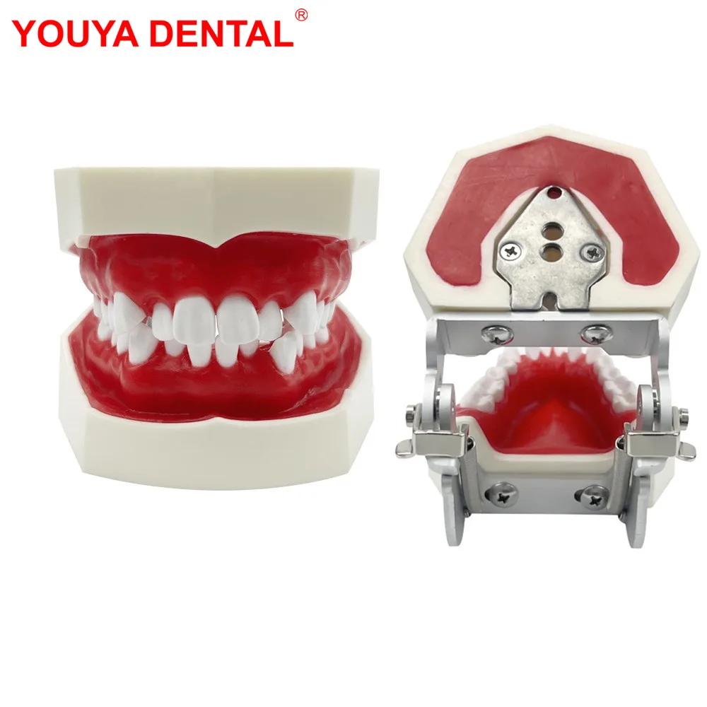 

Dental Practice Model With Red Wax Gum Teeth Model Typodont For Orthodontic Training Teaching Dentist Patient Communication New