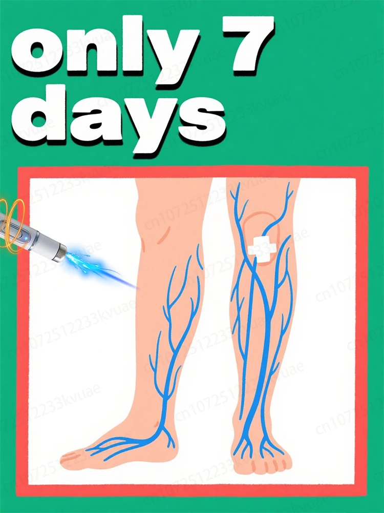 

Bʟᴜᴇ ʟɪɢʜᴛ ᴘᴇɴ ғᴏʀ ᴠᴀʀɪᴄᴏsᴇ ᴠᴇɪɴs. Leg care tools on sale