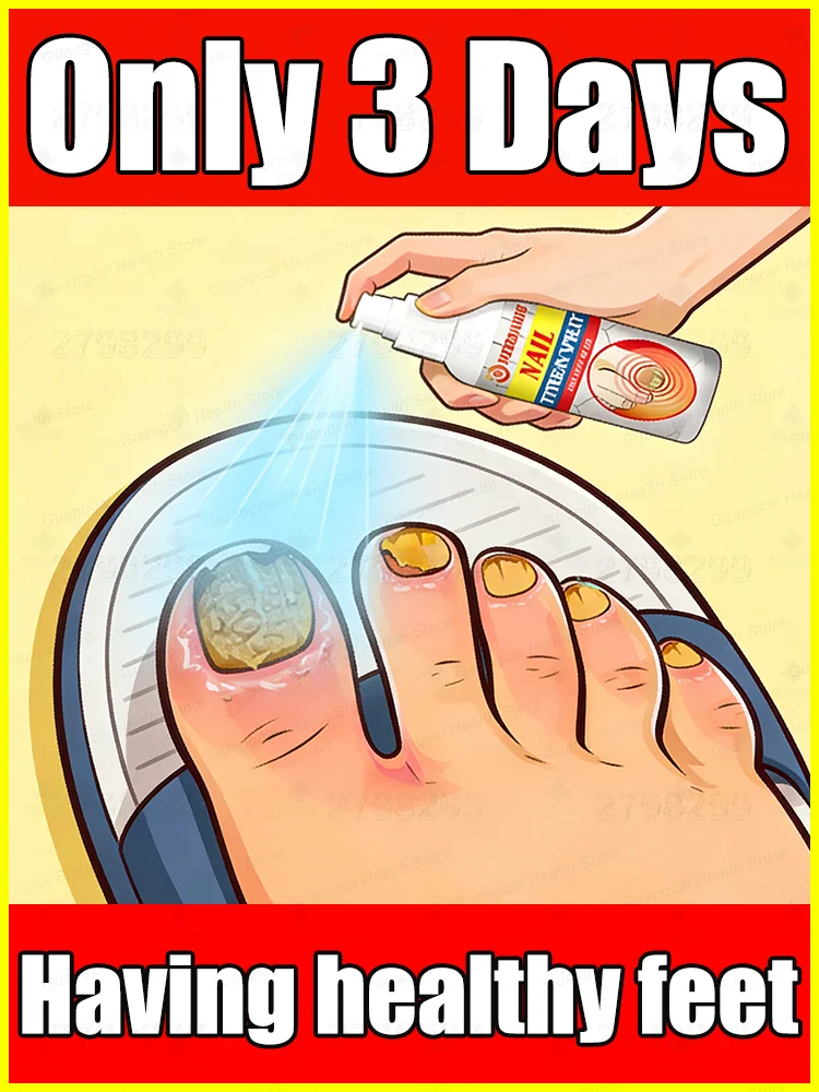 巻き爪修復パッチ、防水、巻き爪矯正ステッカー、変色、損傷、フットケアツール、2025