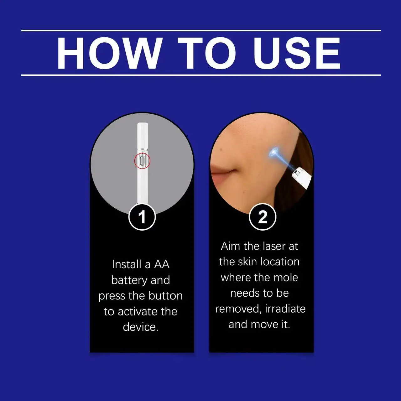 Blue Light Pen Maximum Strength Common and Plantar Wart Falling off warts care tool