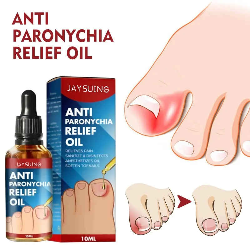 10ML Anti Paronychia Relief Oil Repair Nail Inlay Thickening Nail Polish Brightening Gray Nail Polish Groove Care Oil