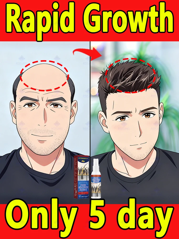 

Visible scalp Gone in a week with this bottle